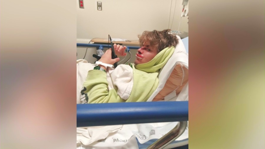 Bear Attack in San Bernardino County Raises Safety Concerns