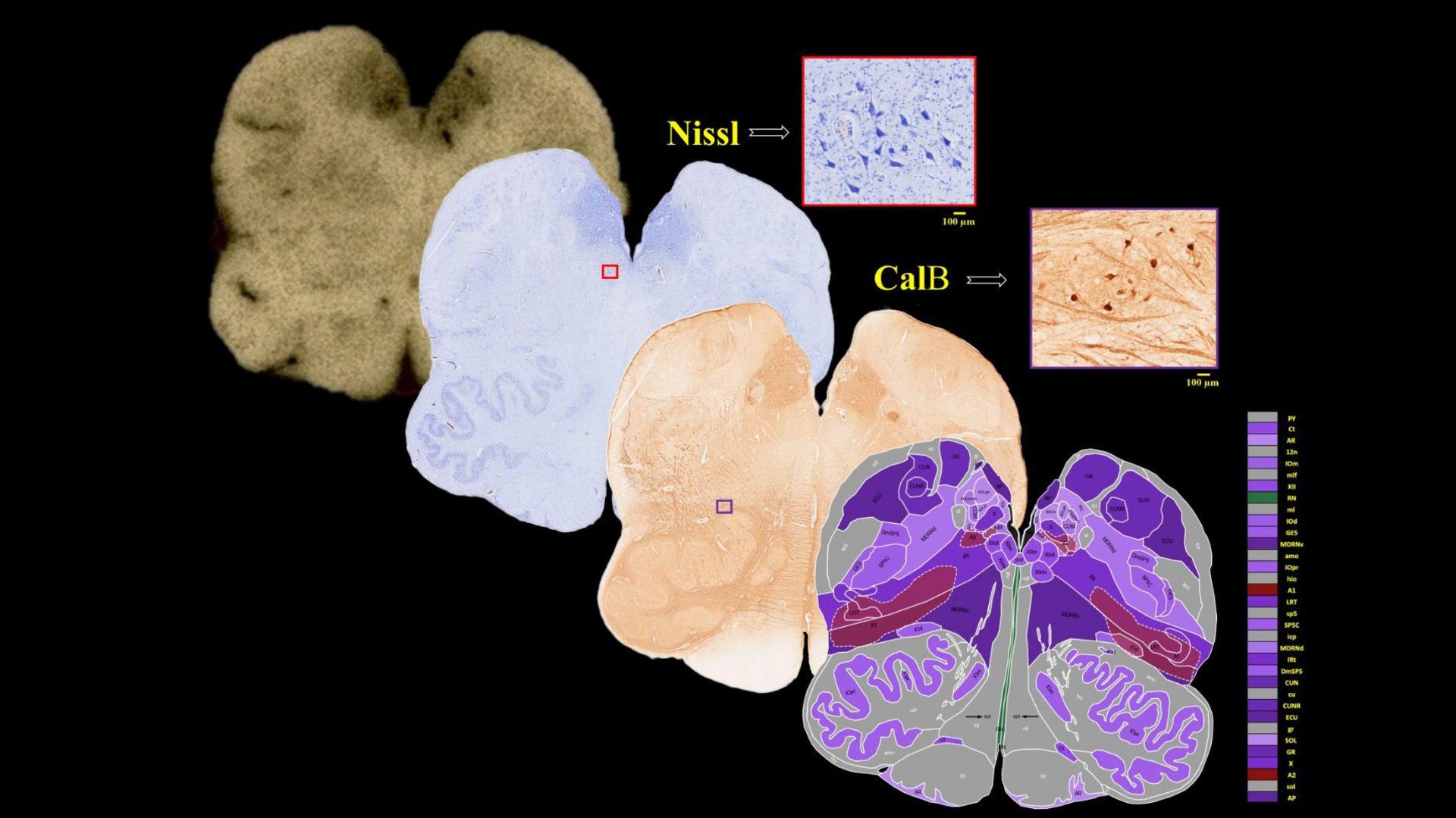 How Indian scientists are mapping the brain's last frontier