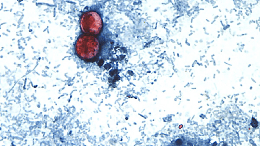 CDC: Nearly 7,000 cases of cyclosporiasis being investigated