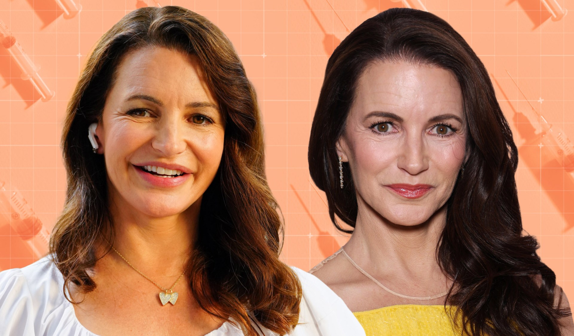 The Great Facial Filler Backlash: “It Got Carried Too Far”