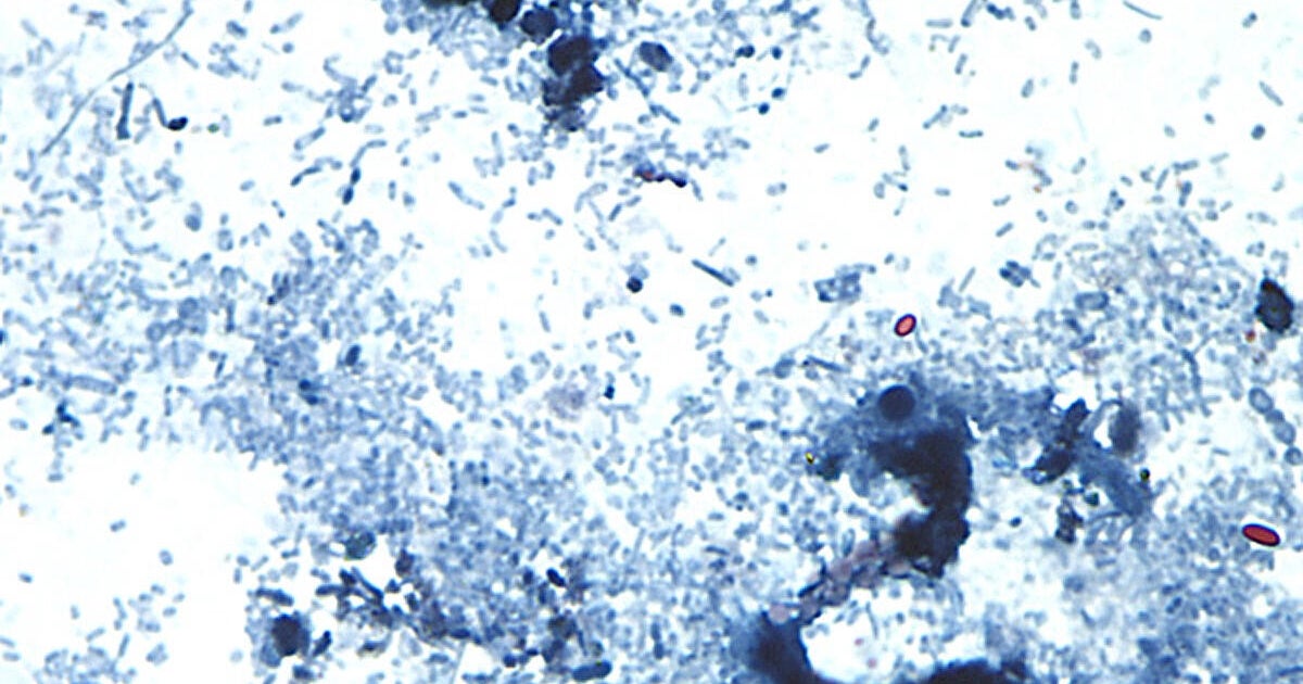 What to know about "explosive" diarrhea-causing parasite reported in several states