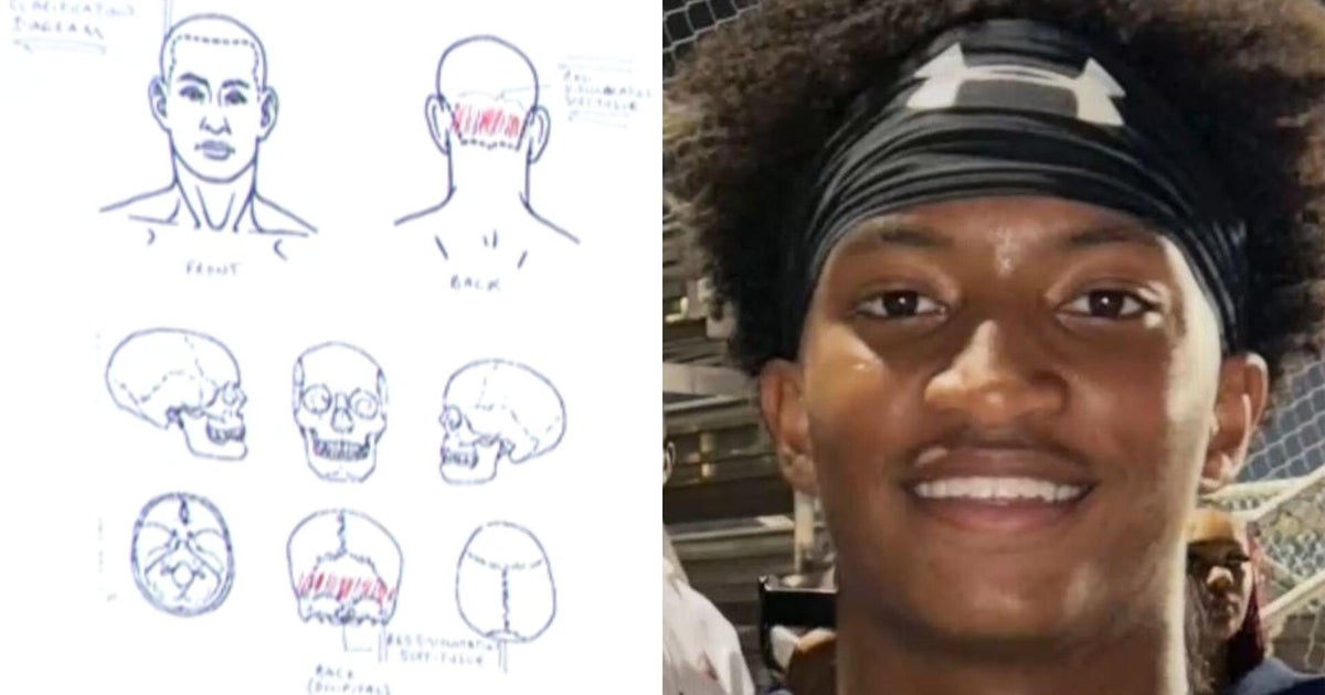 What Nolan Wells' preliminary independent autopsy findings revealed about his death