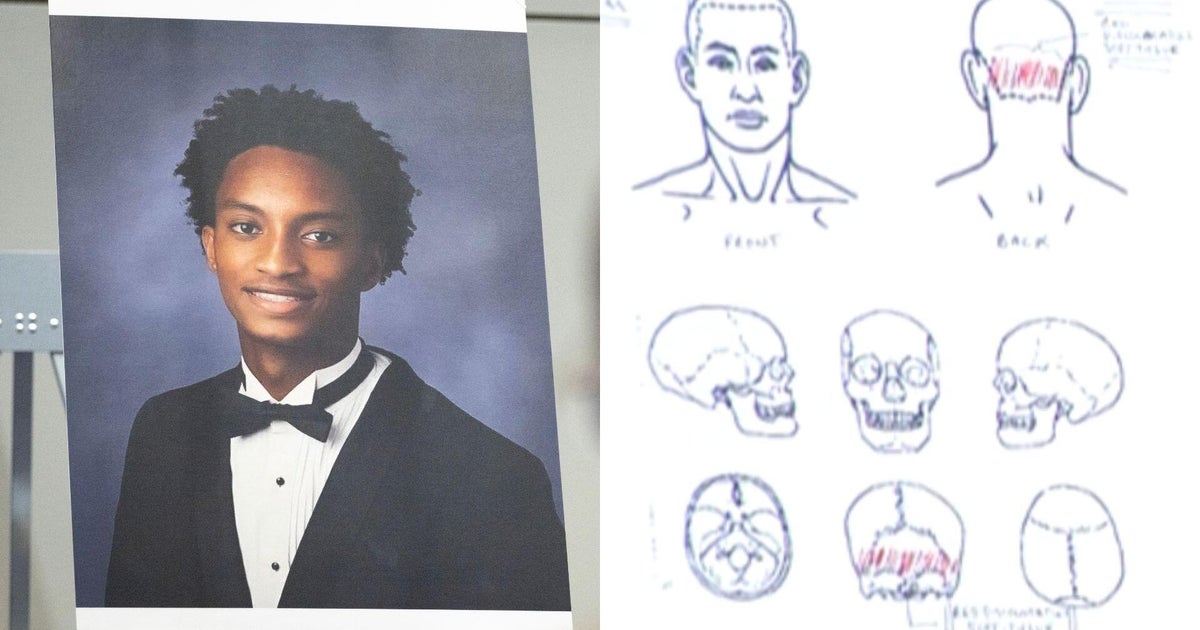 New questions emerge in Nolan Wells' death after family's independent autopsy