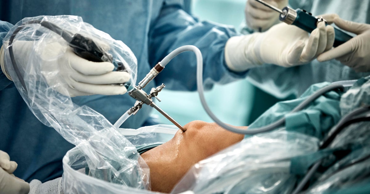 Common knee surgery may do more harm than good, 10-year study shows