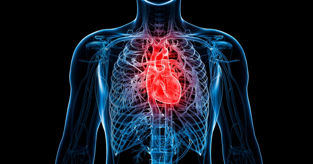 Sen. Lindsey Graham just died of aorta disease. My husband did too.