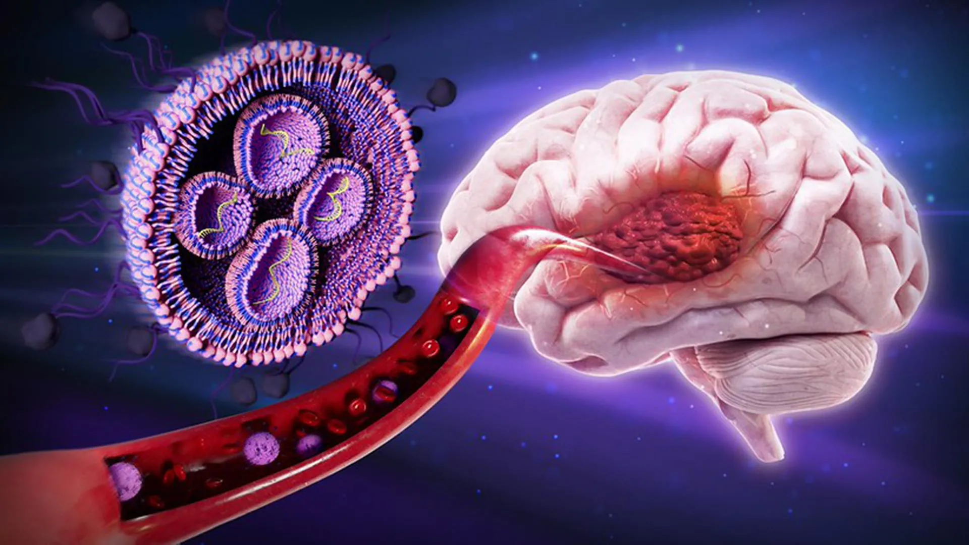 This sugar-coated therapy boosted survival against deadly brain cancer by 50% in mice