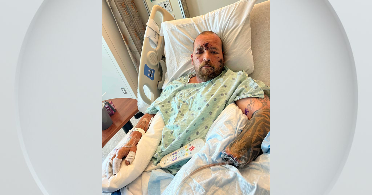 Man picking up debris loses hand after blast on California beach, family says