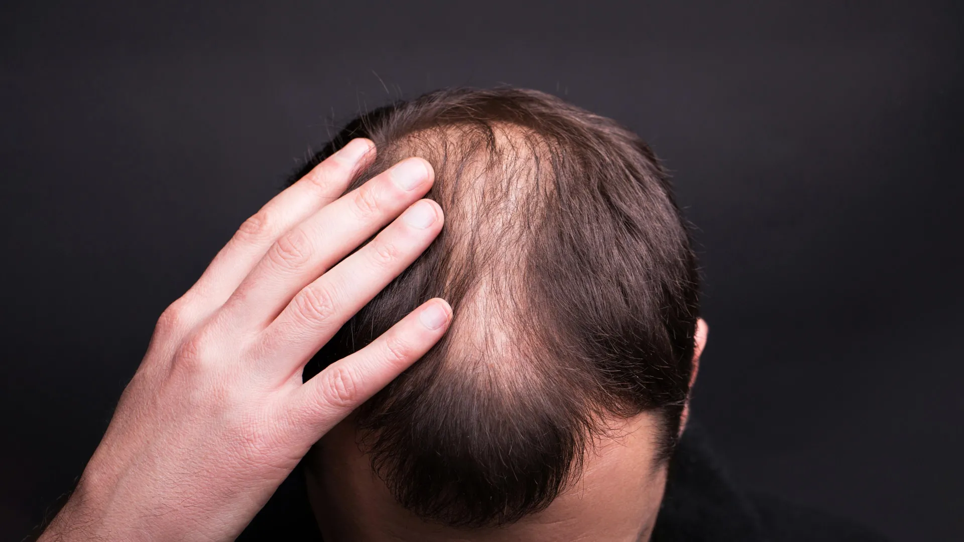 Textbooks were wrong: Scientists reveal how human hair really grows