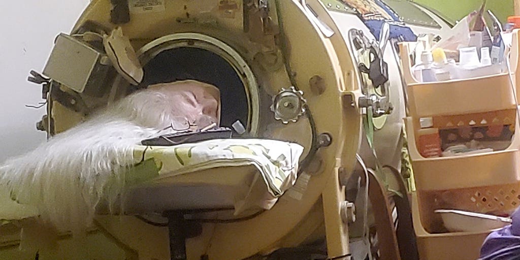 Last American to use an iron lung dies at 78 years old after childhood polio diagnosis