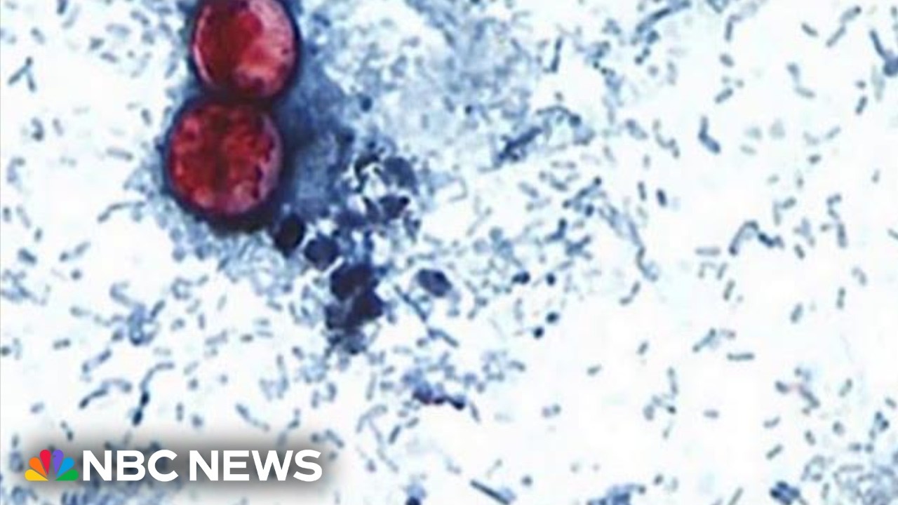 Cases of illness that causes explosive diarrhea on the rise across the U.S.