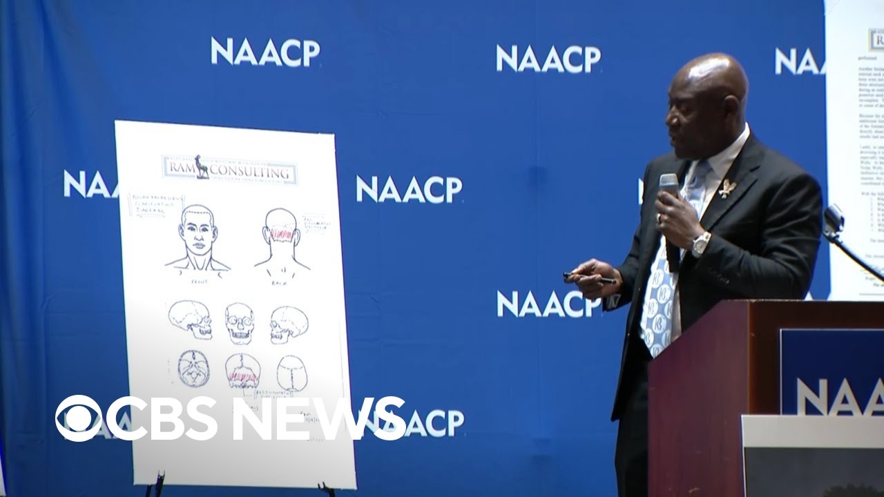 Nolan Wells’ preliminary independent autopsy results read by attorney Ben Crump