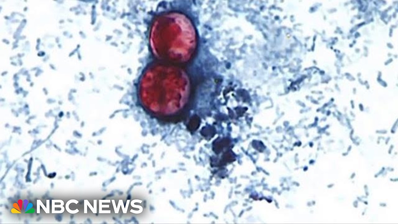 Federal program cuts spark concern over FDA and CDC response to cyclospora