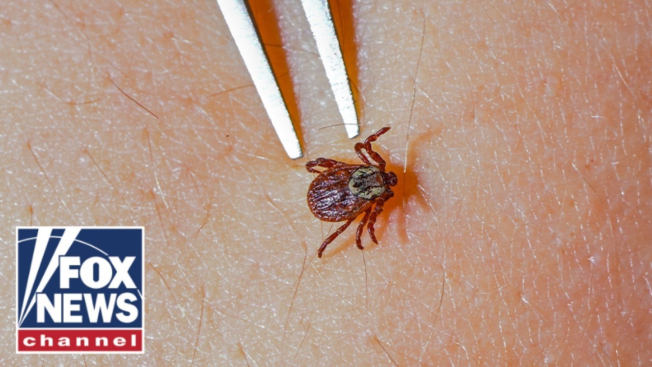 Rare tick-borne virus SURGES as summer camp season begins