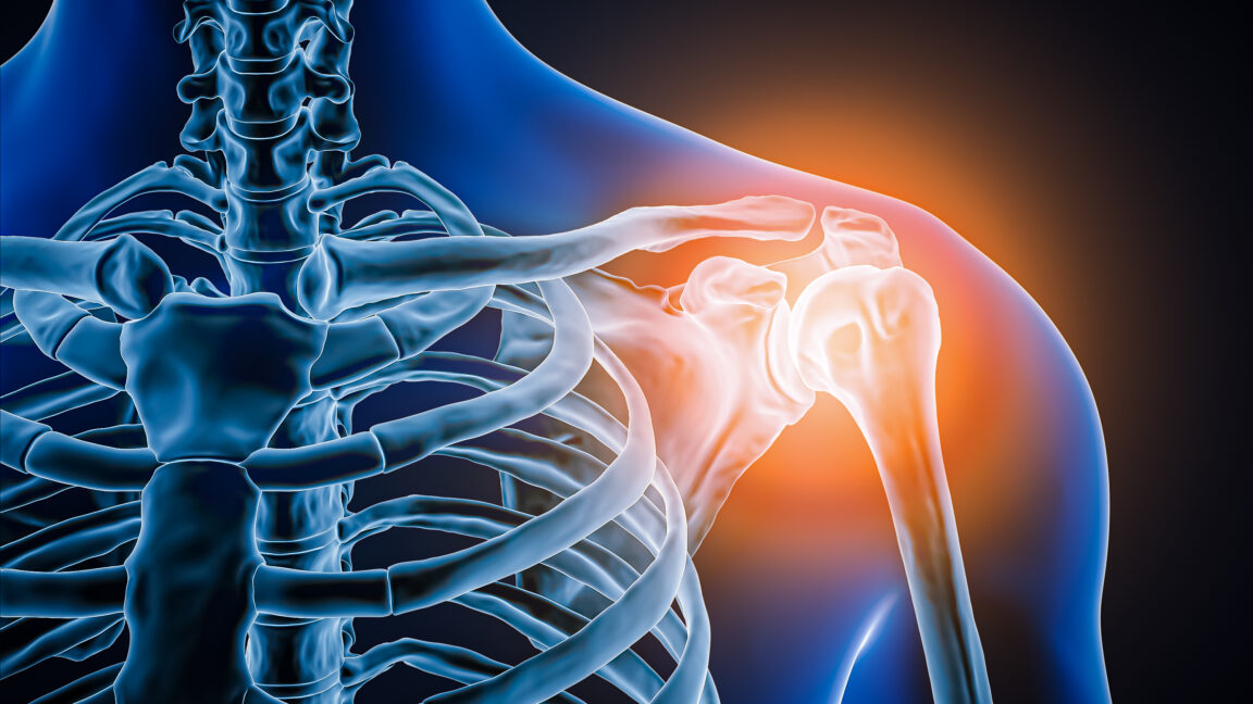 Doctors took a look at man's painful shoulder—they found the joint was missing
