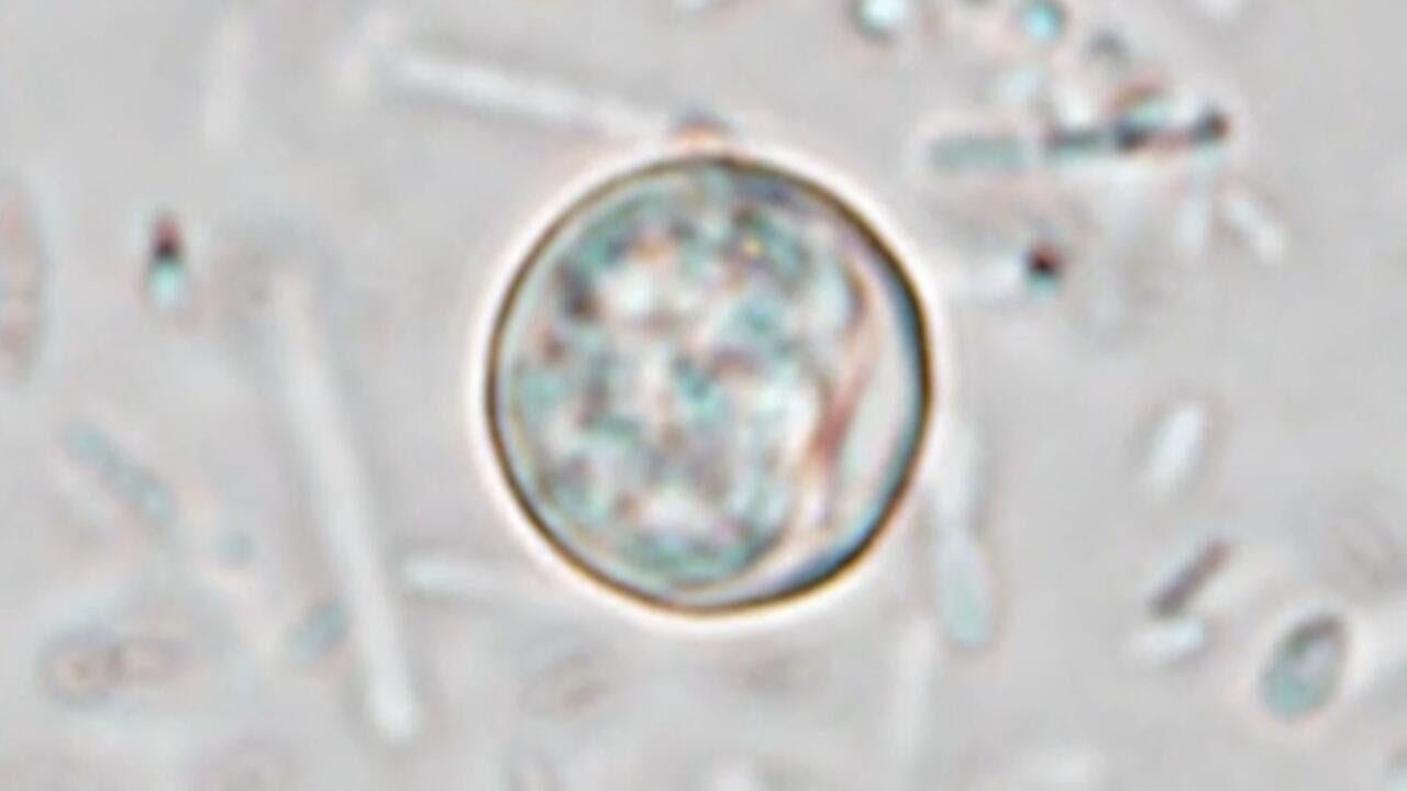 Michigan health official details effort to mitigate cyclosporiasis outbreak
