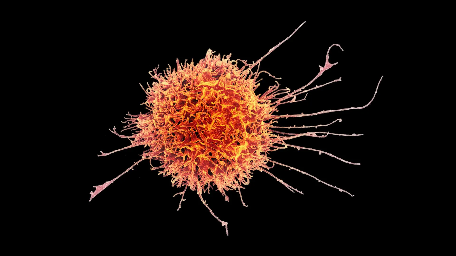 Supercharged “natural killer” cells could be a powerful new cancer weapon