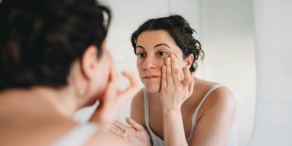 Skin condition under the eyes goes viral as doctors warn it could signal hidden health issue