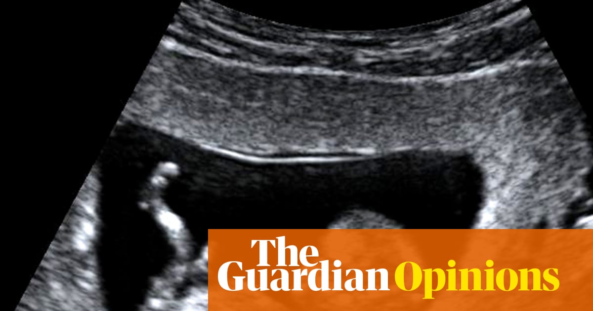We terminated a pregnancy so our daughter never had to suffer. It was agony. It cannot be the right of One Nation – or any anti-abortion activist – to choose for us | Anonymous