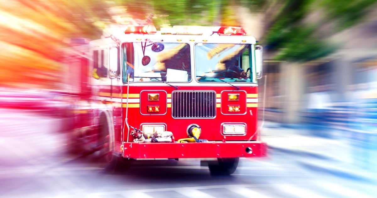 Dallas firefighters face burn injuries after battling blaze at home, officials say – CBS News