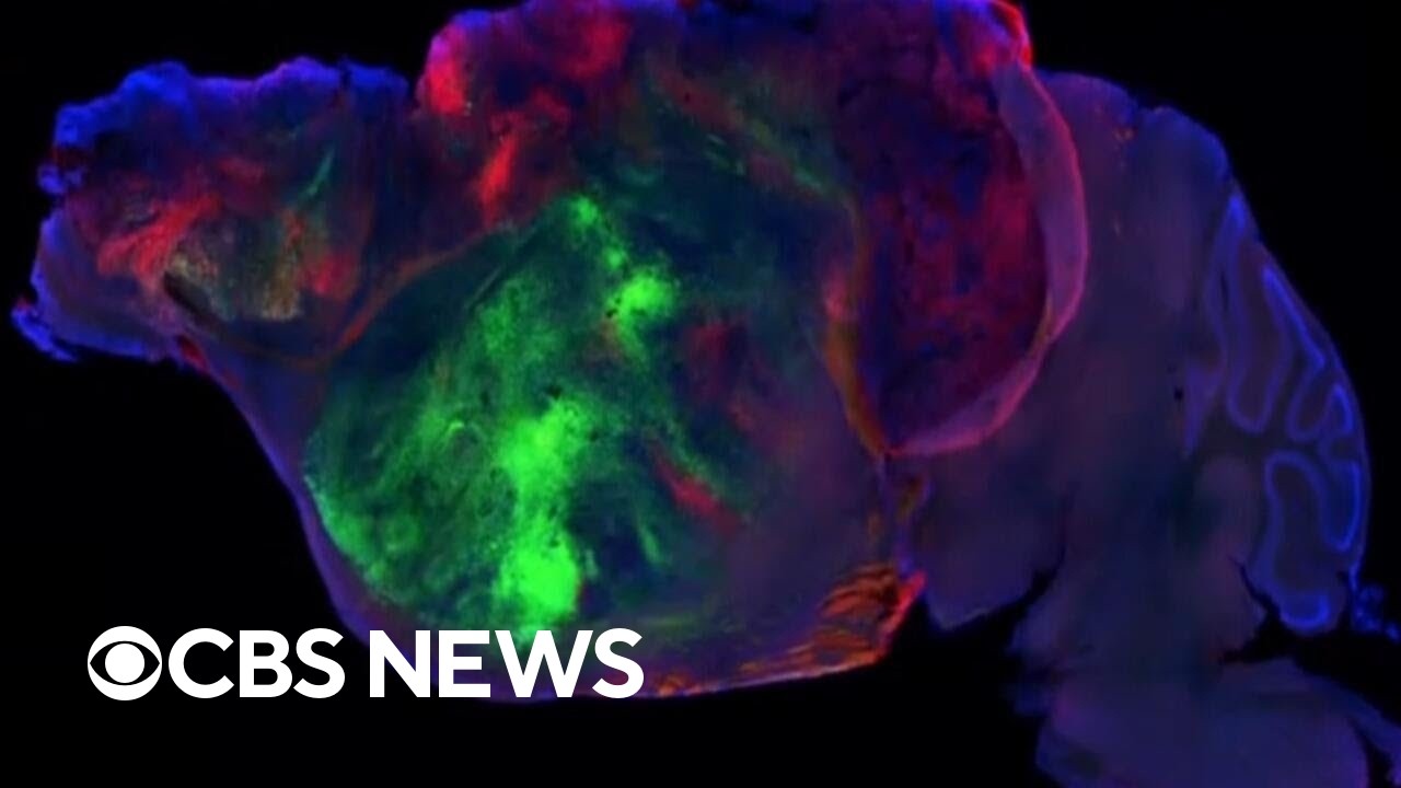 Neuroscientists grew human brain tissue in mice. This is what they discovered.