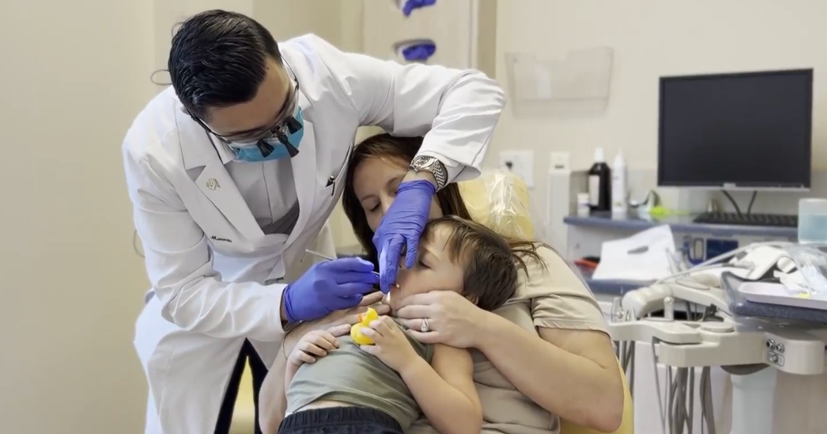 Metro Atlanta dentist works to expand dental care for Georgia Medicaid patients – CBS News