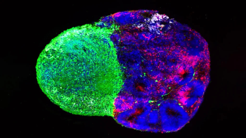 Scientists reveal the hidden instructions that build the human brain