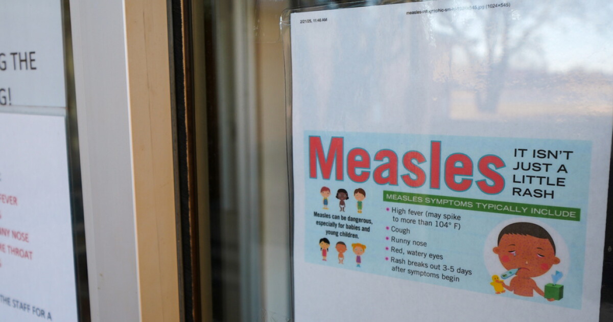 CA Dept. of Public Health notifies public of possible measles exposure related to train, bus passenger – 23ABC News Bakersfield