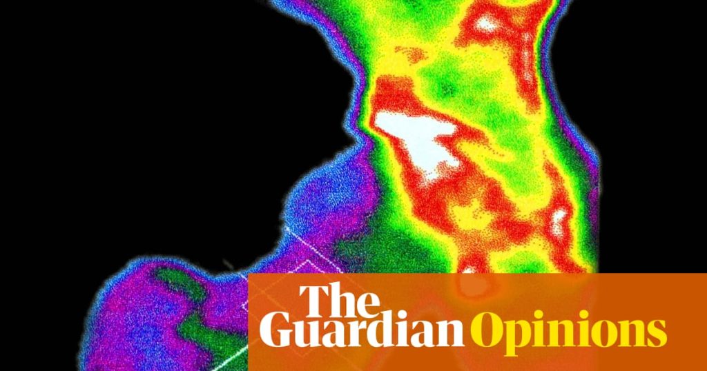 Are your bones brittle? If they were, how would you know? (To men: this goes for you too) | Ranjana Srivastava