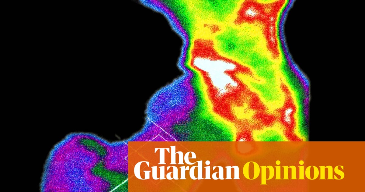 Are your bones brittle? If they were, how would you know? (To men: this goes for you too) | Ranjana Srivastava