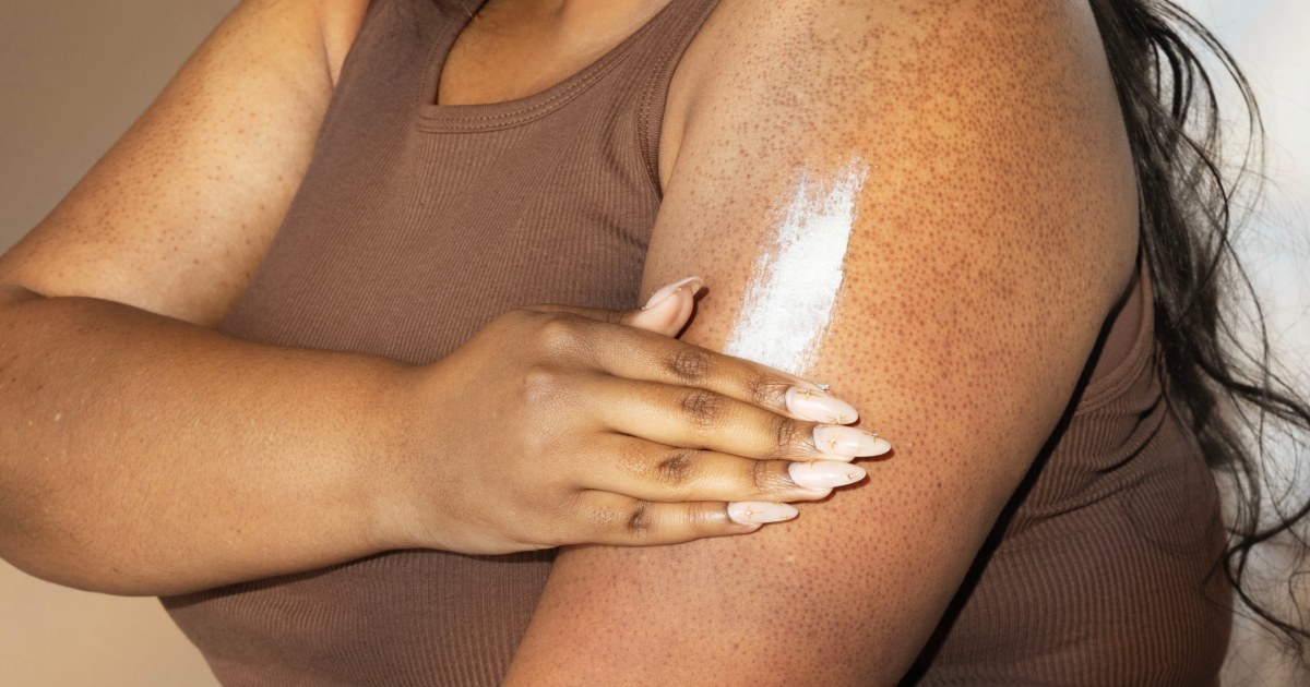 The best products for treating keratosis pilaris
