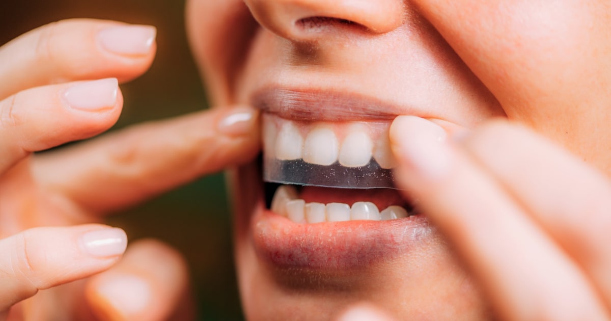 Not all teeth whitening strips work the same — these 4 stood out in our testing