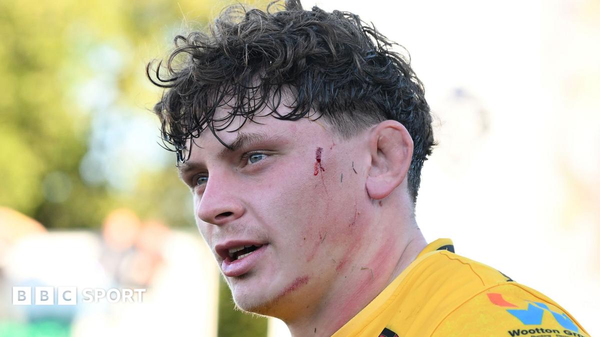 Dragons suffer Woodman bicep injury blow