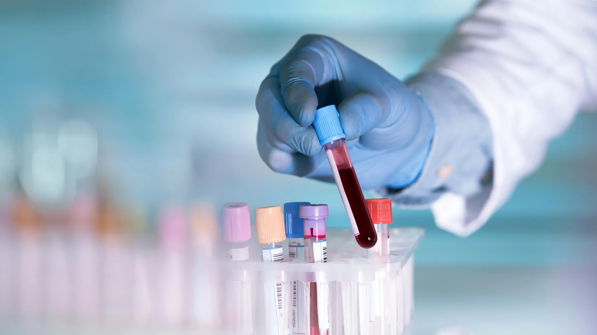 Your blood could reveal inflammatory bowel disease 10 years before diagnosis