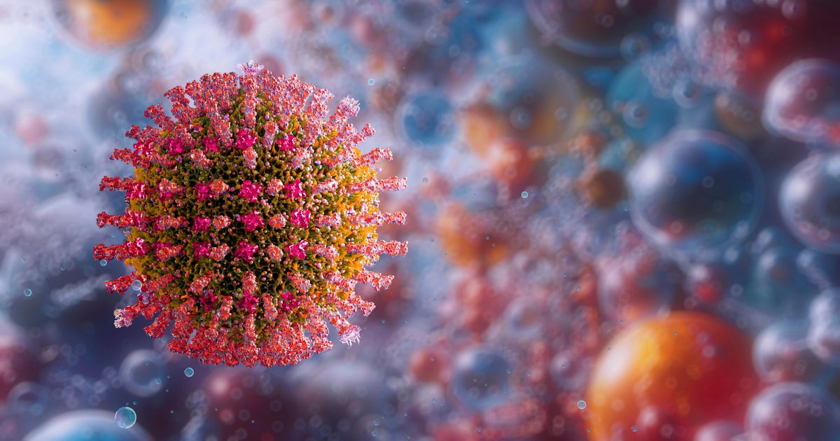 Georgia measles cases hit 21 in 2026, with 5 new cases connected to Jasper County family – CBS News
