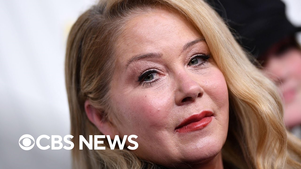 Doctor explains how a misdiagnosis of multiple sclerosis happens amid Christina Applegate news